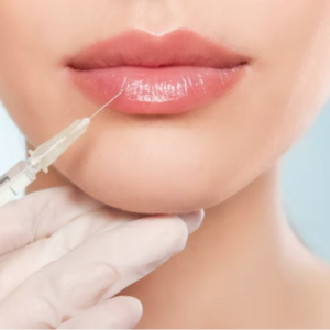 JUVÉDERM® ULTRA + LIP FLIP! ($350 WITH REBATE *WHILE SUPPLIES LAST*)