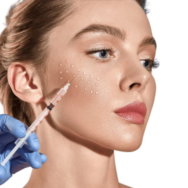2 SYRINGES OF SKINVIVE™ BY JUVÉDERM®