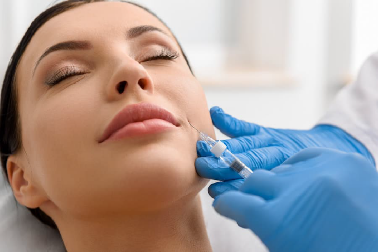 NASAL FOLDS